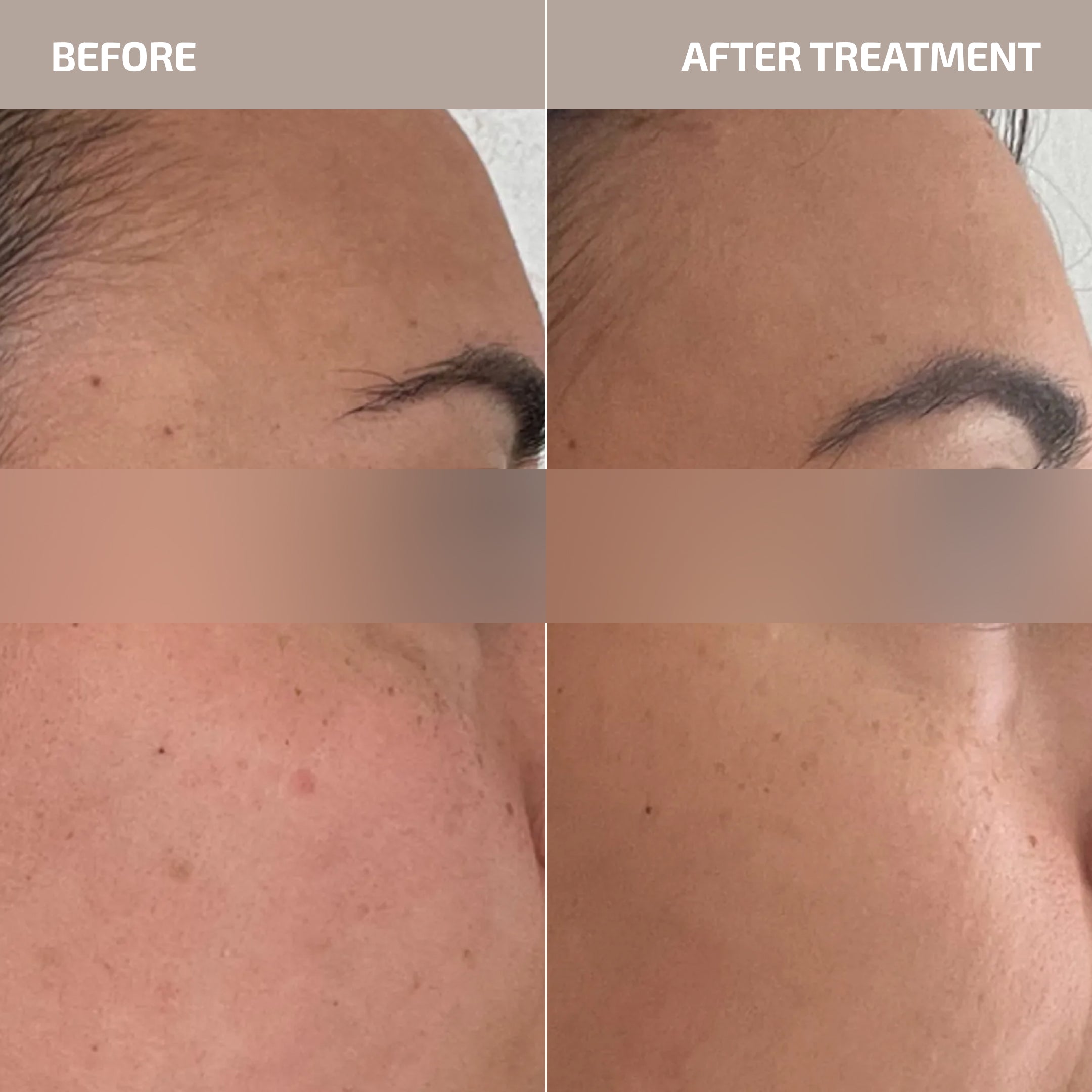 ANTÜ Skin Barrier Daytime Defense Moisturizer