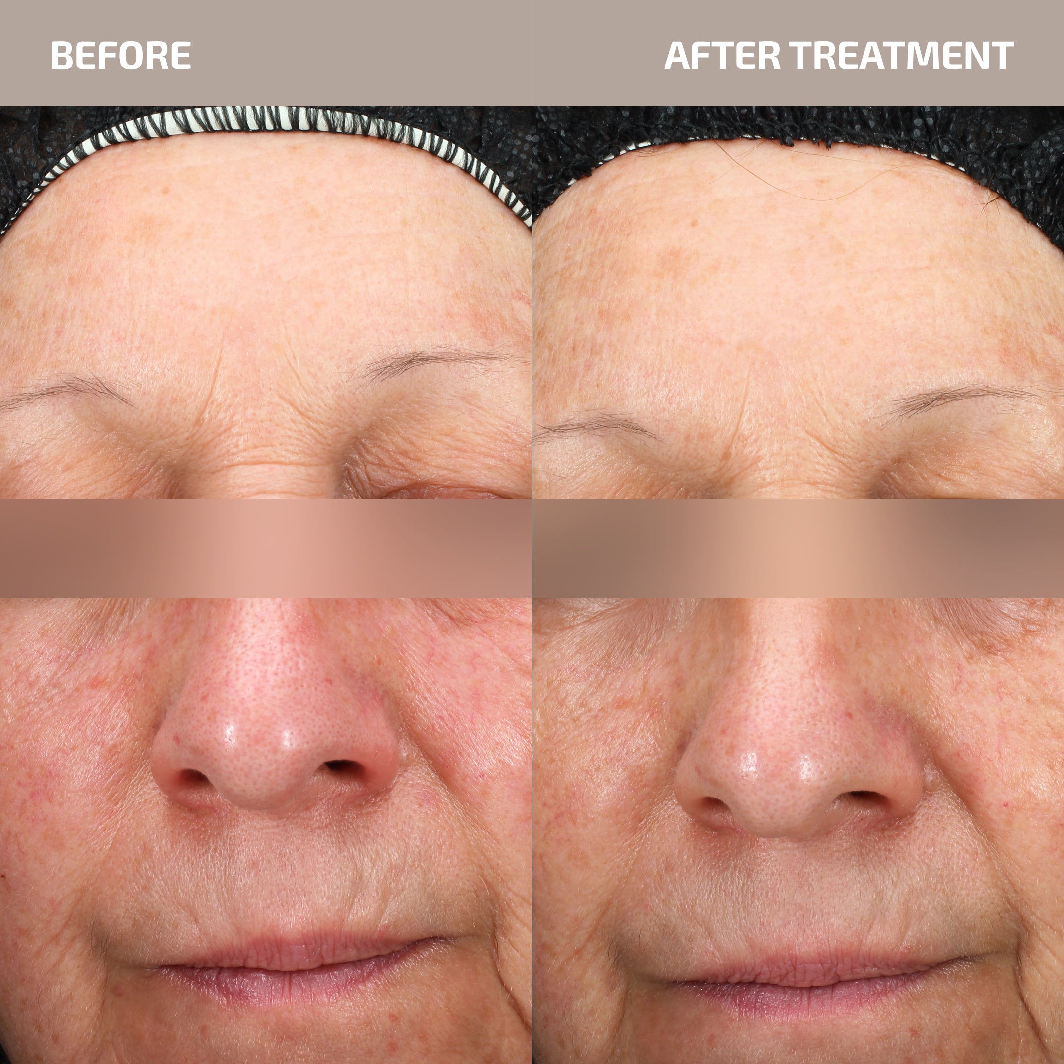 Skin Barrier Repair Set