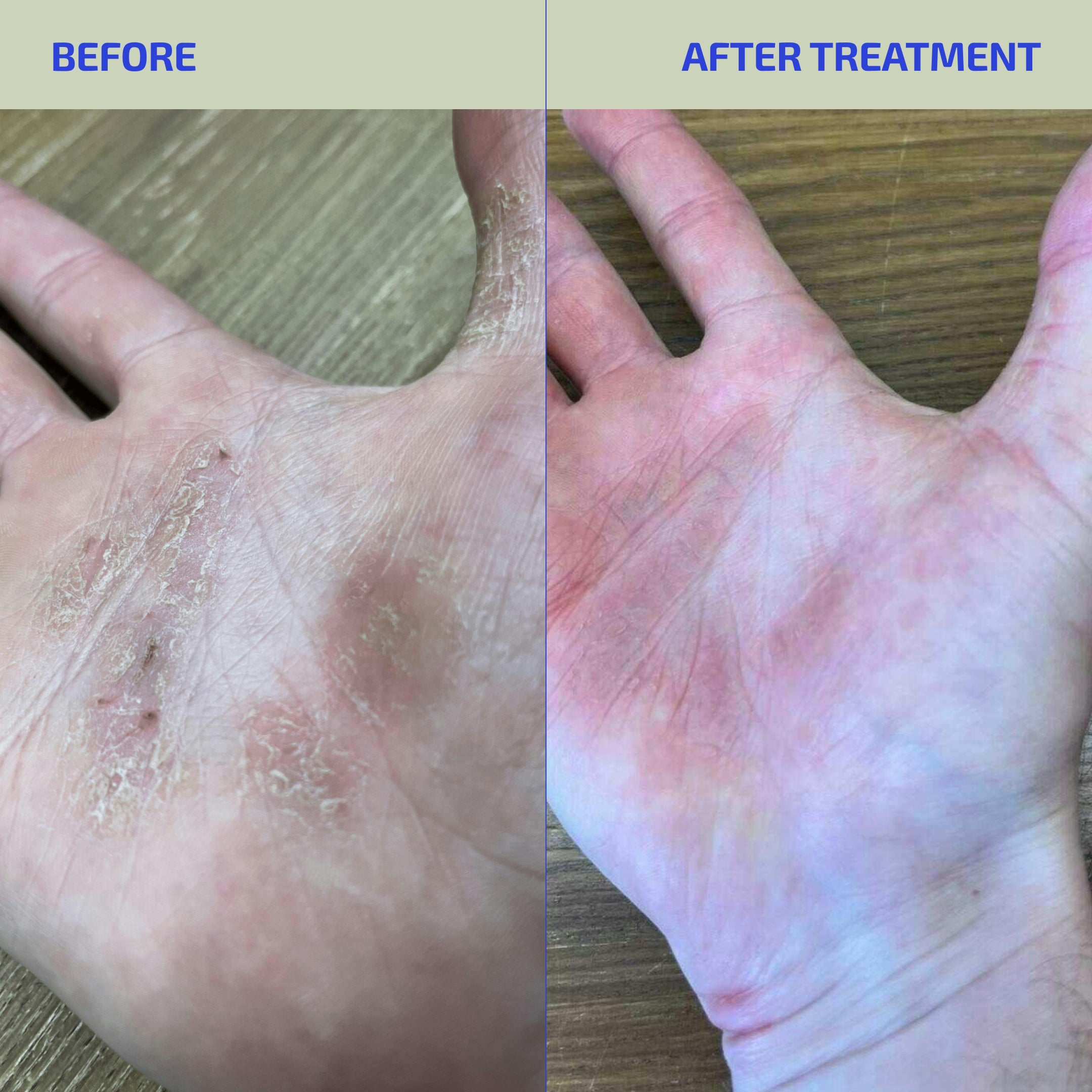 Gut Barrier Support Set