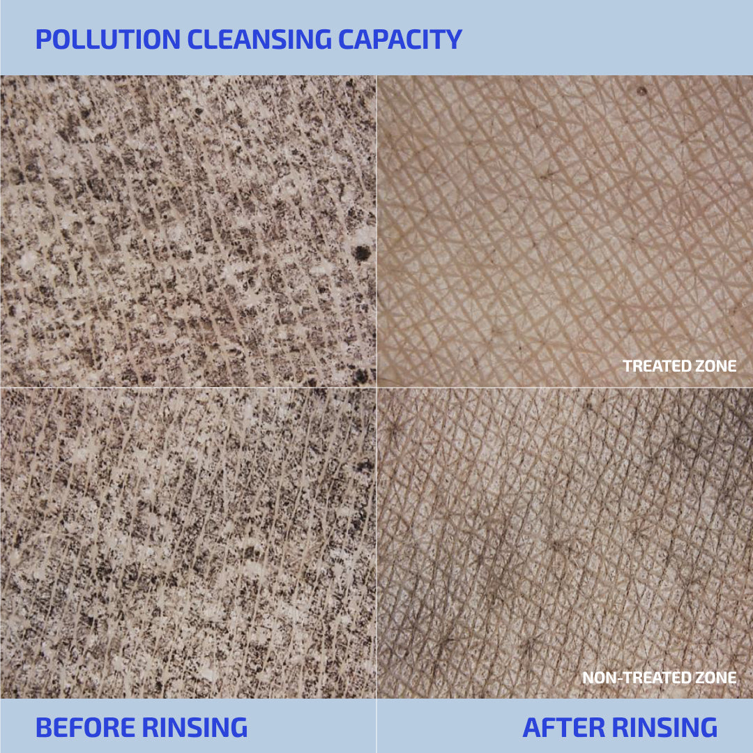 SHAANT Pore Purifying Acne Face Scrub