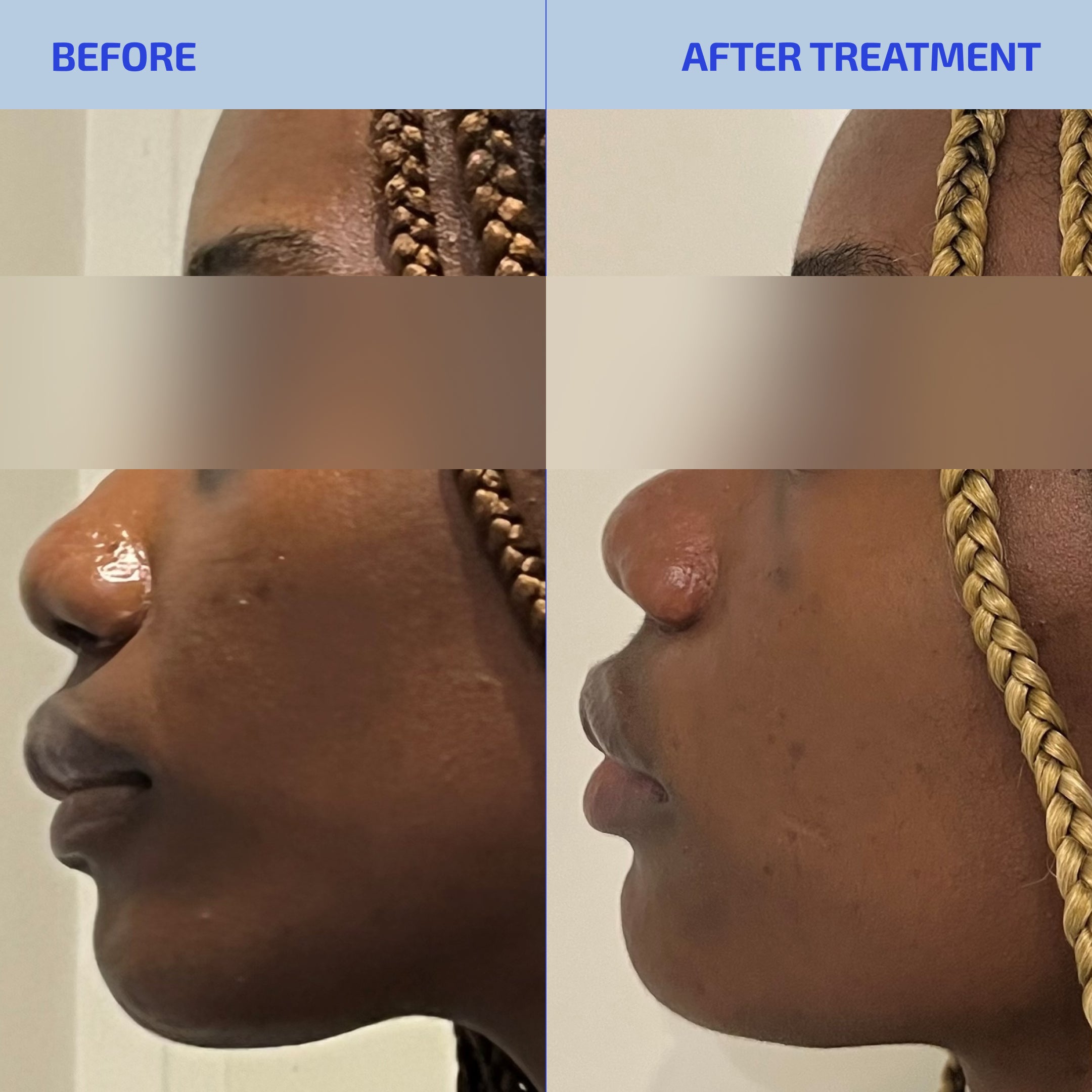 SHAANT Balancing Foaming Cleanser