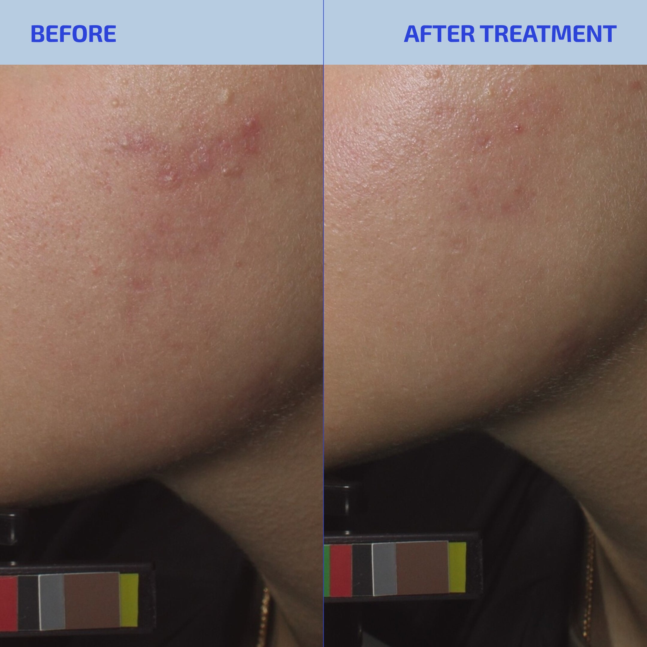 SHAANT Balancing Refining Toner