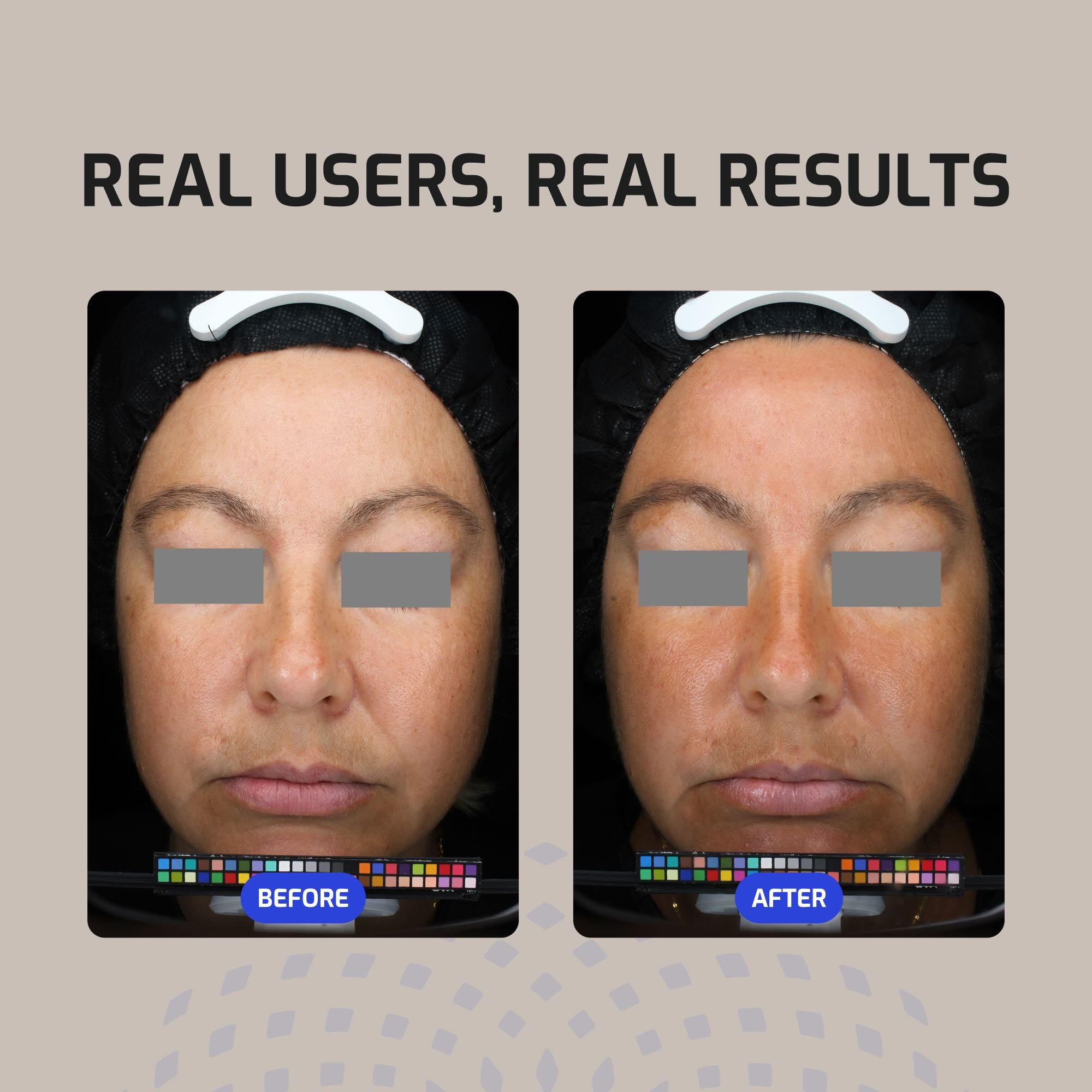 Antü Skin Barrier Moisturizer before and after image.