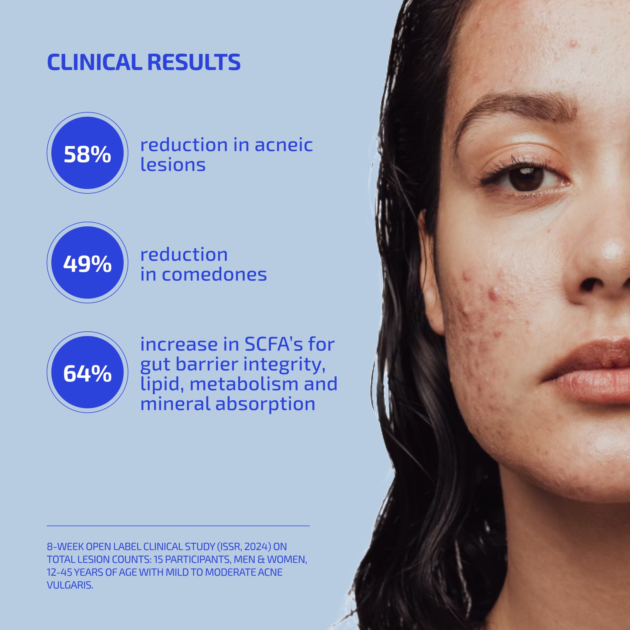 SHAANT ClearSkin Probiotic Supplement 2.0 for Acne-Prone Skin