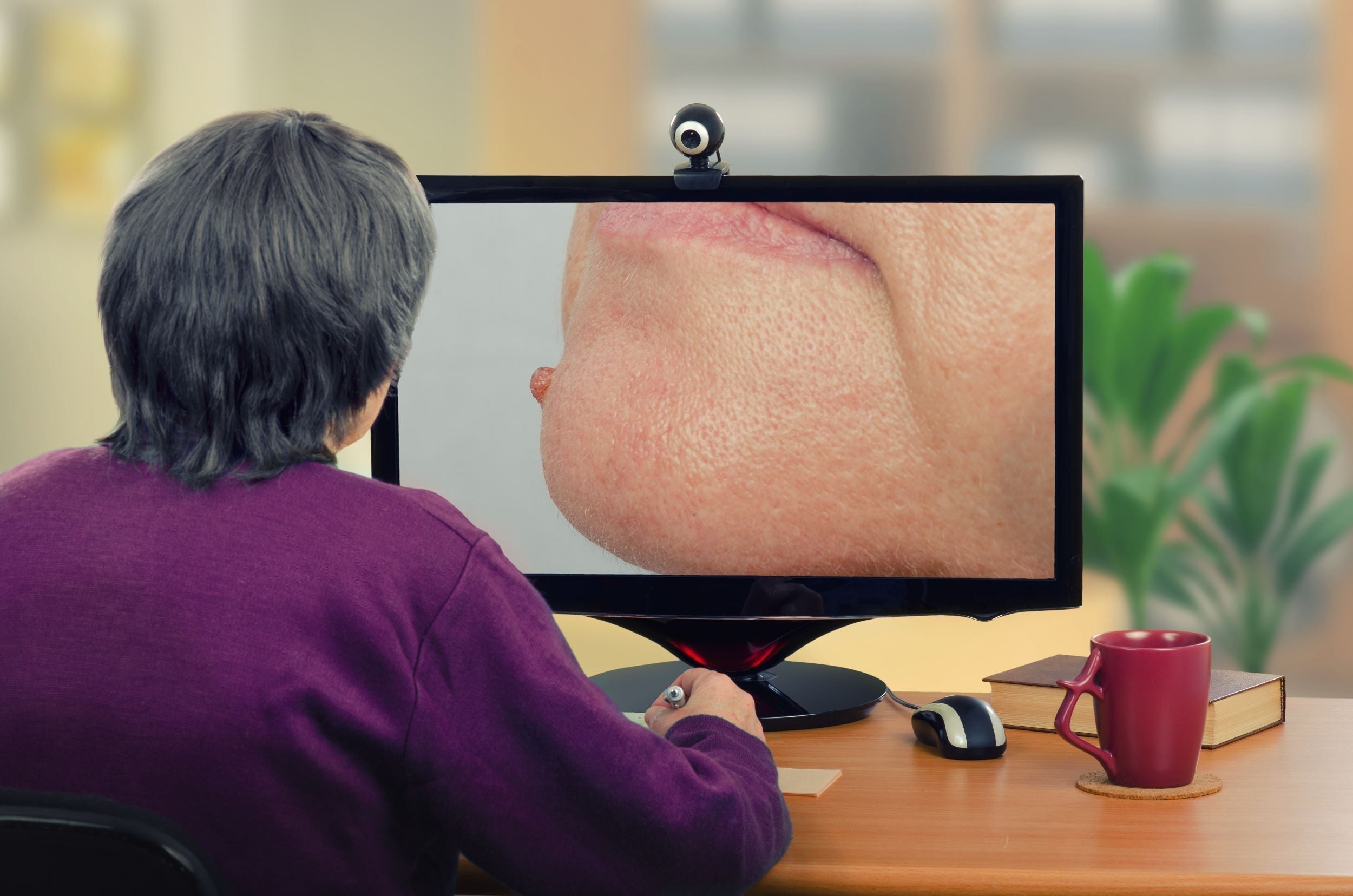 The Rise of Teledermatology: Transforming Skin Care in the Digital Age