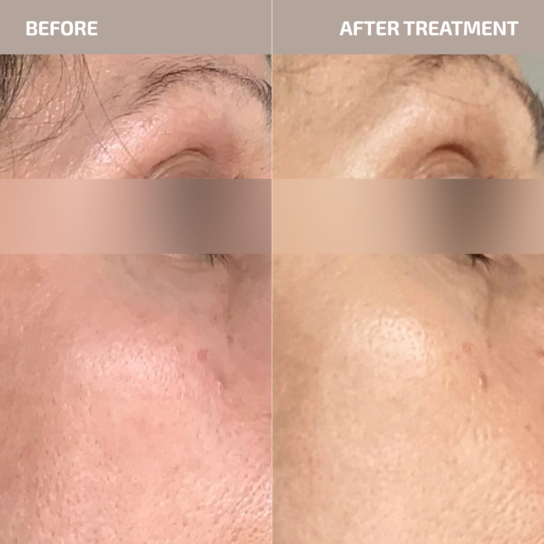 ANTÜ Overnight Repair Cream