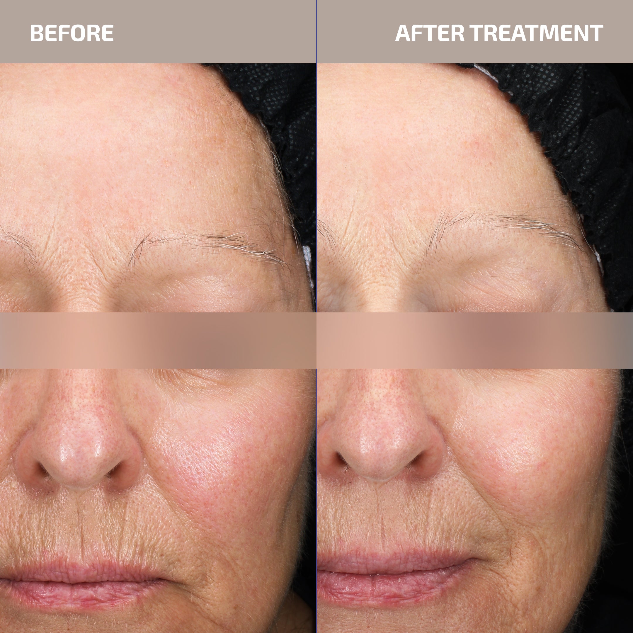 ANTÜ Skin Barrier Serum