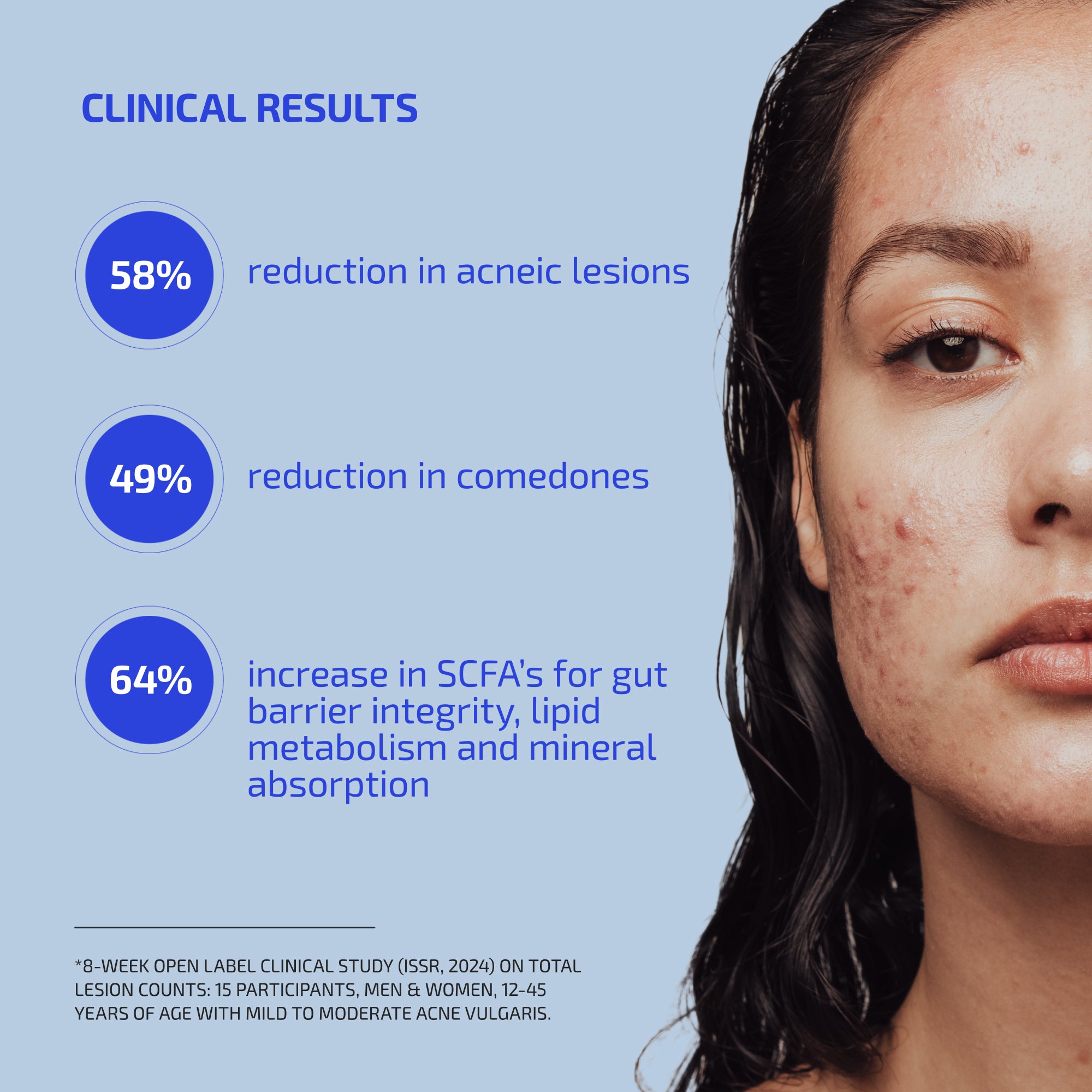 SHAANT ® ClearSkin Probiotic Supplement 2.0