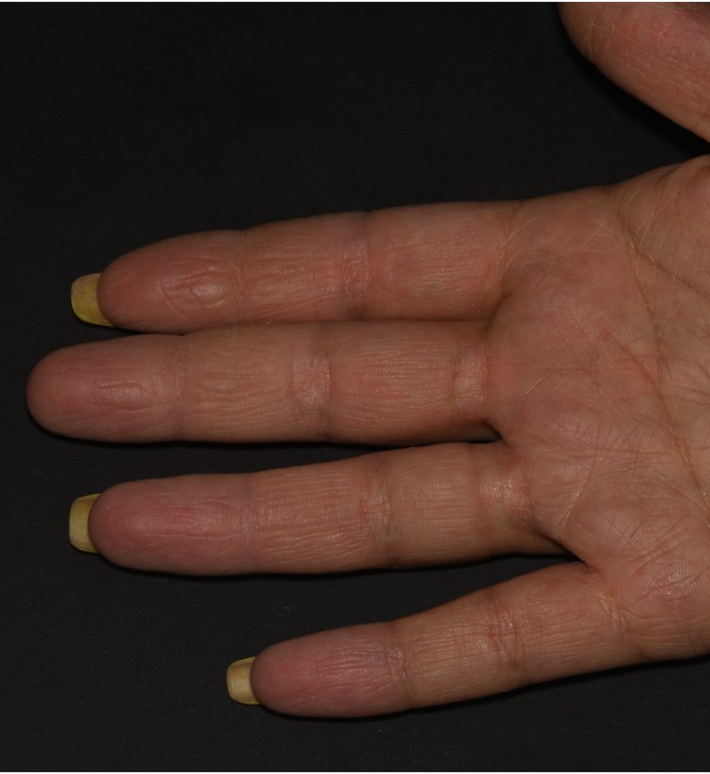 After Image