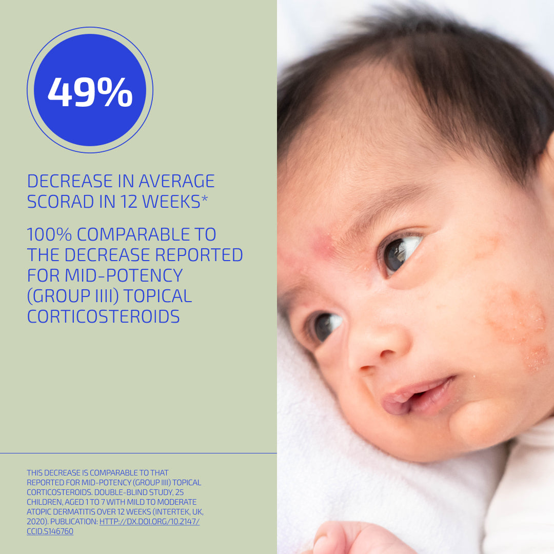 Skin Barrier Eczema Relief System (Infant: 3-12 months)