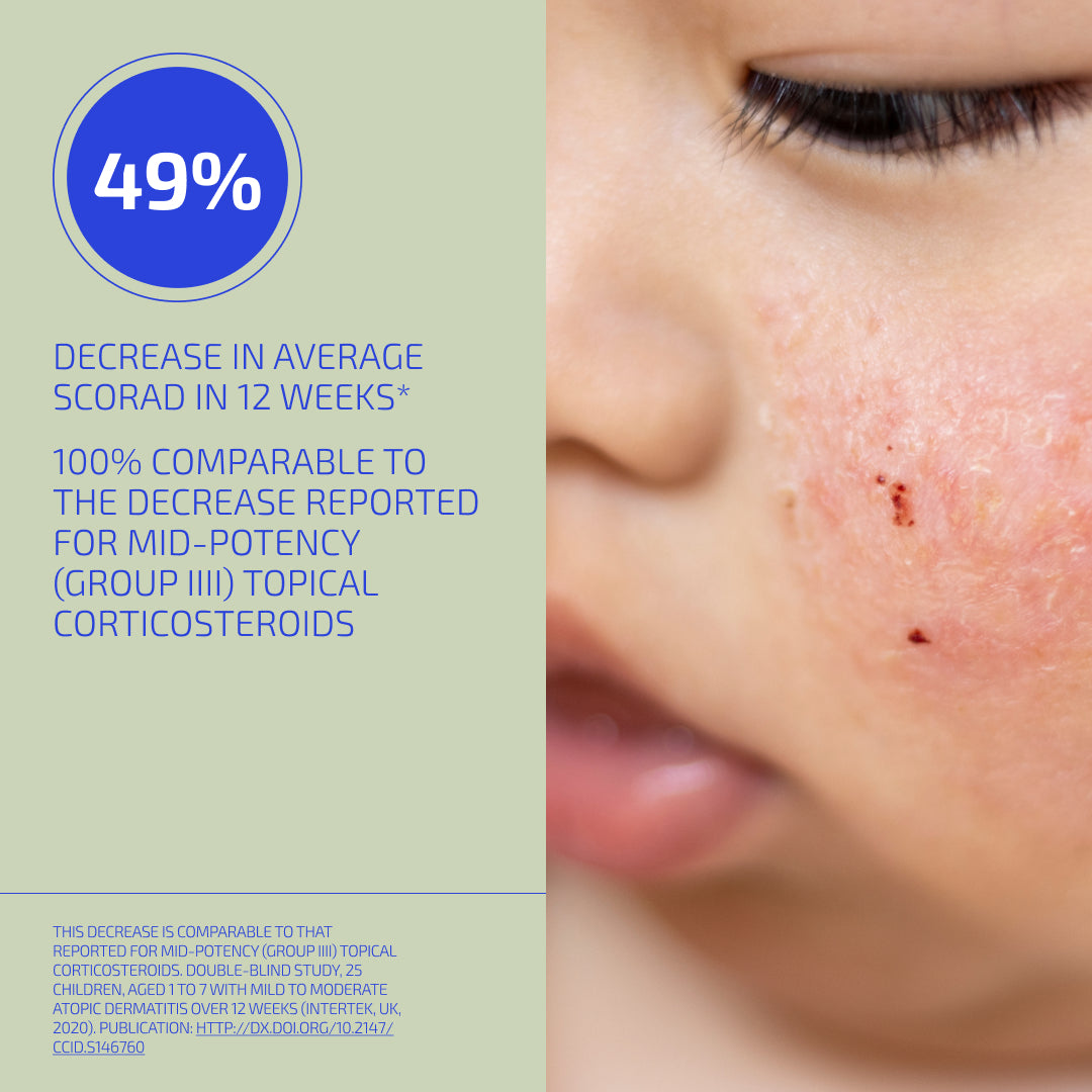 Skin Barrier Eczema Relief System (Toddler: 1-3)
