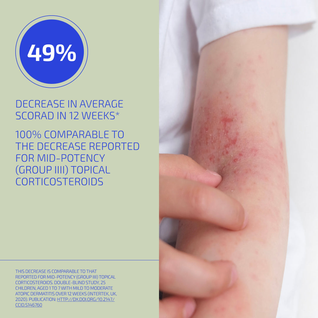 Skin Barrier Eczema Relief System (Kids: 4-12)
