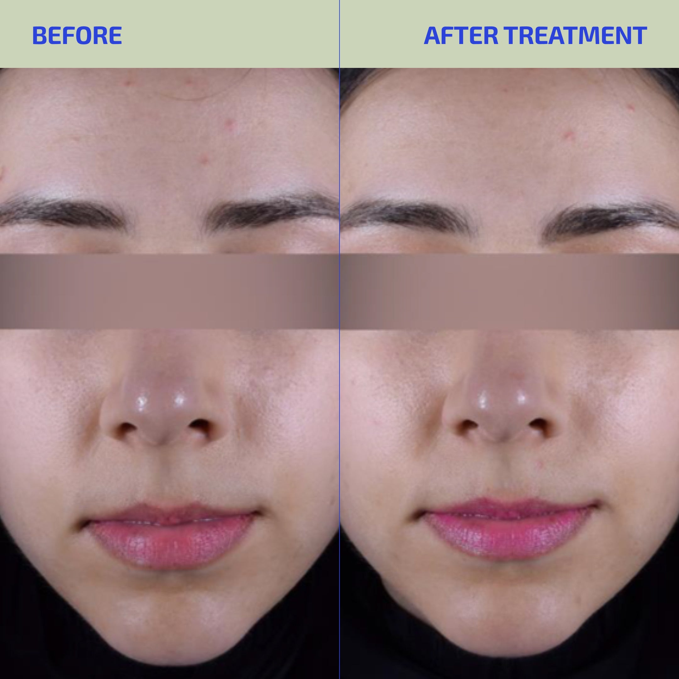 Bia Hydrating Skin Superfood 2.0