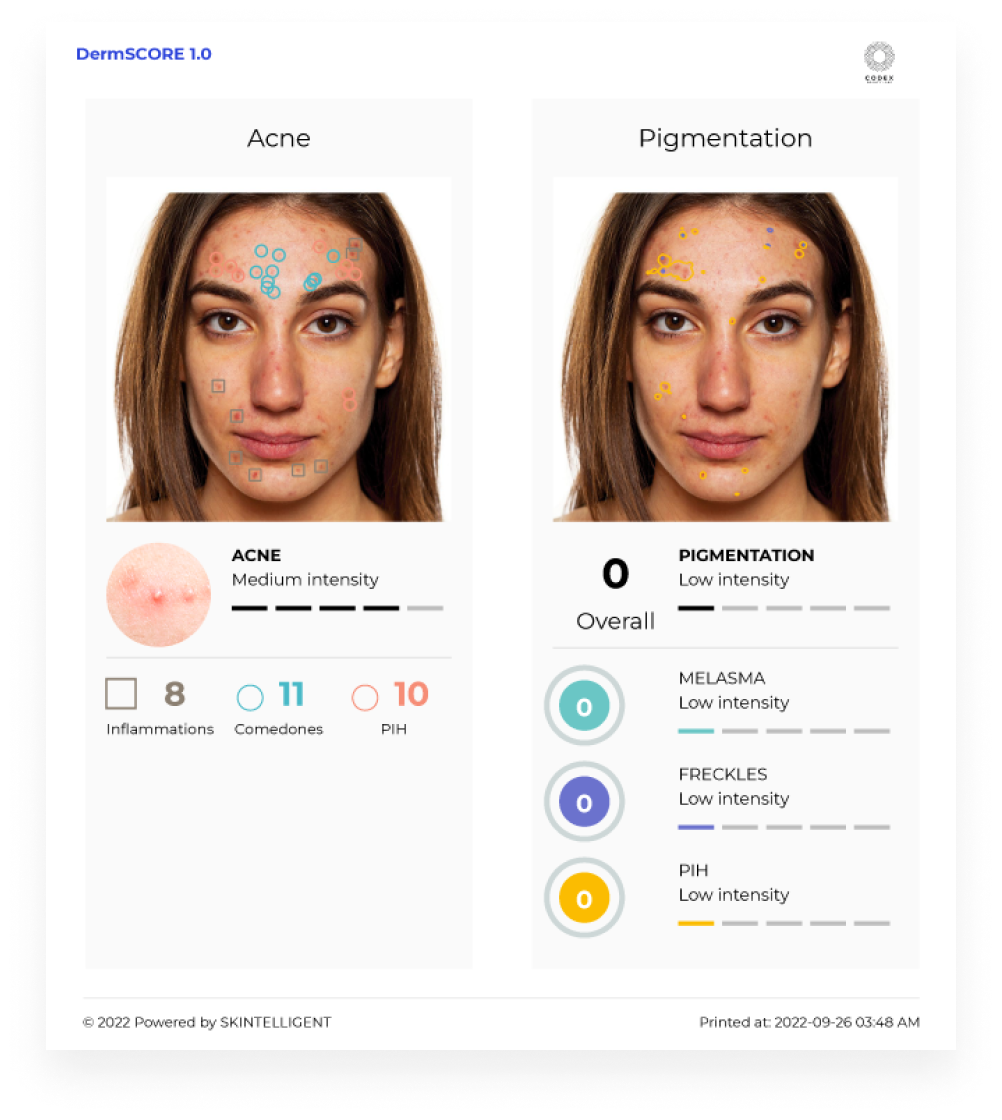 Dermscore app showing acne and pigmentation results.