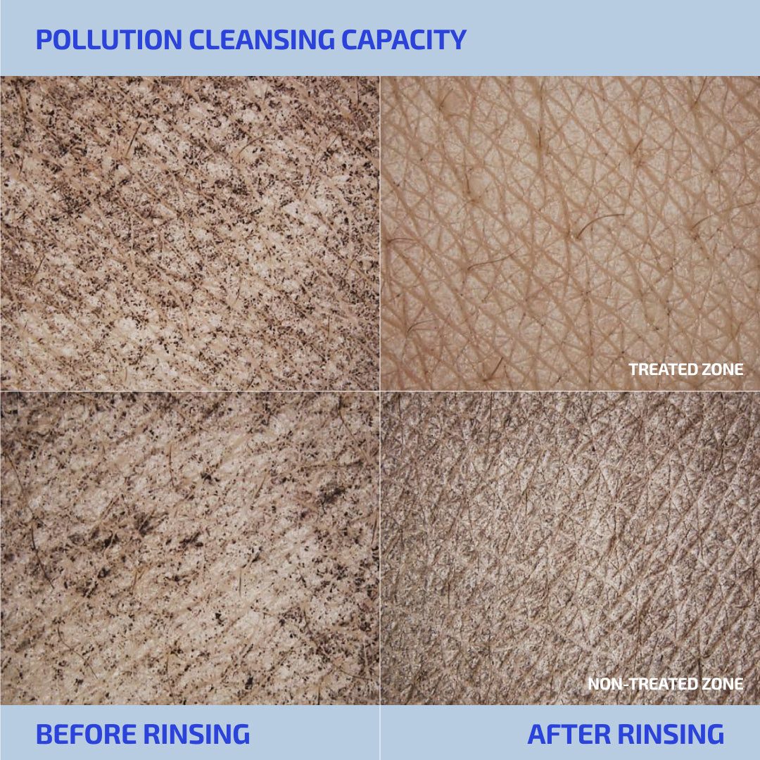SHAANT Hydrating Acne Body Scrub