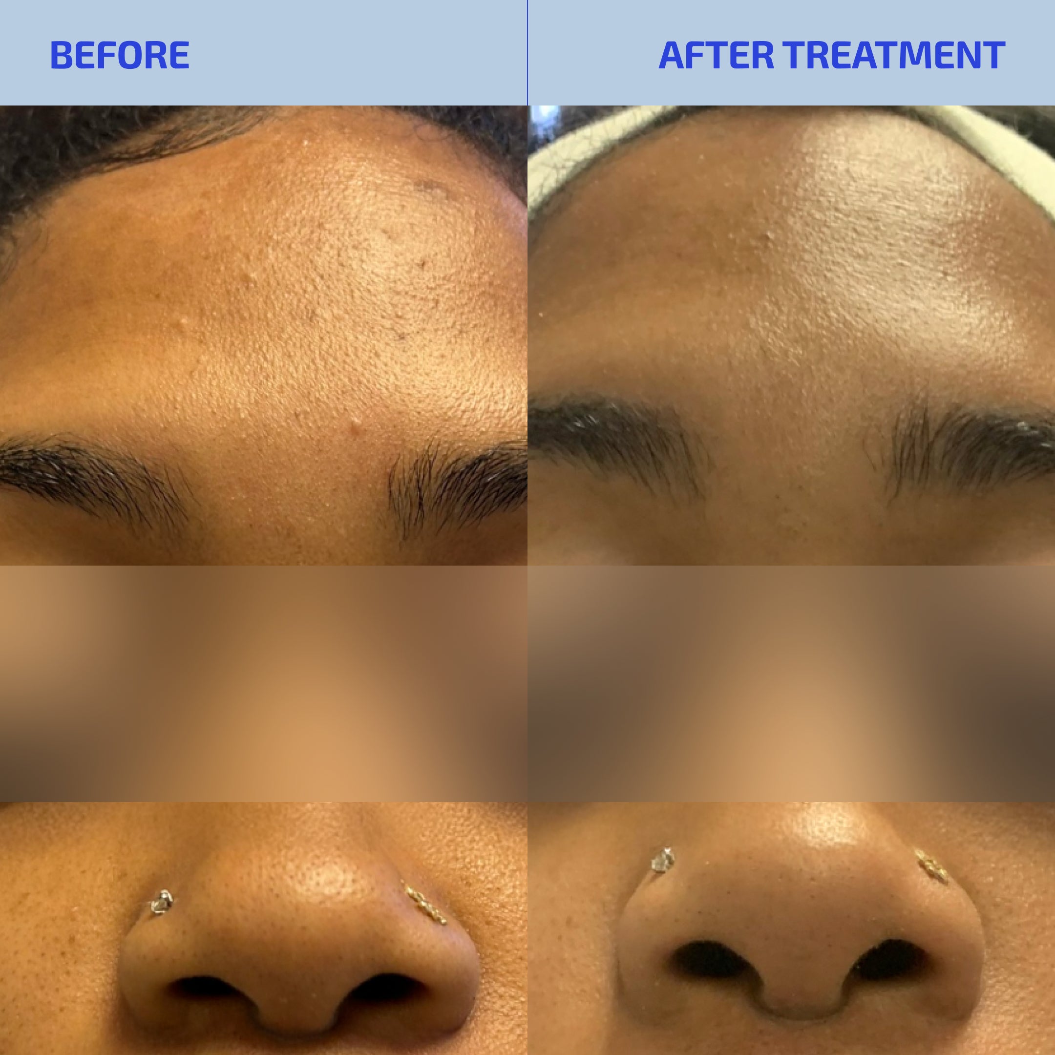 SHAANT Balancing Clay Mask