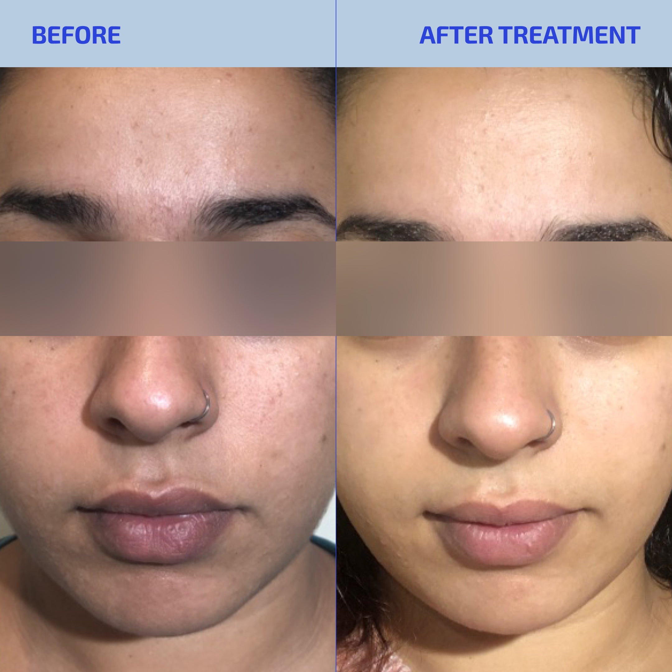 SHAANT Smoothing Oil Control Cream