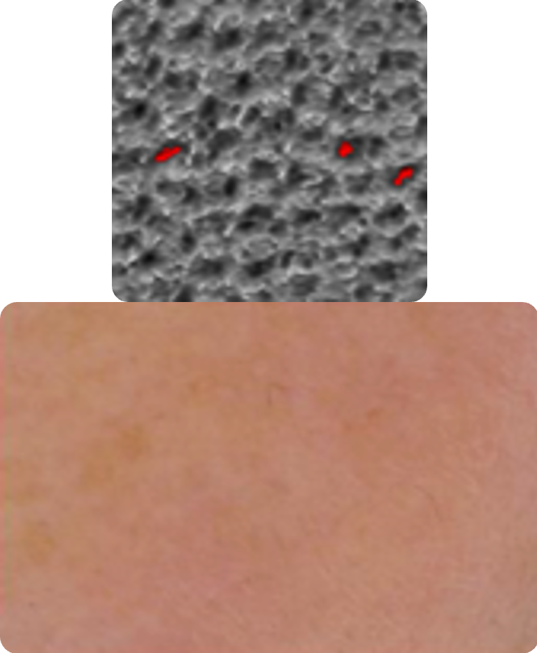 After Image
