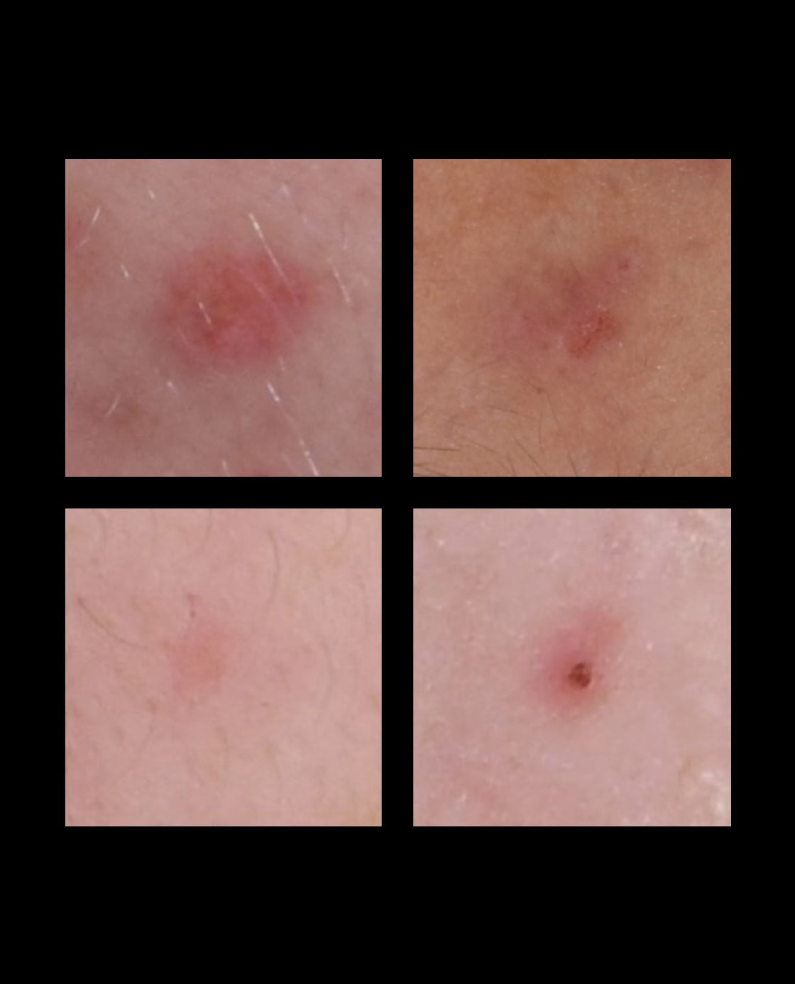 After Image