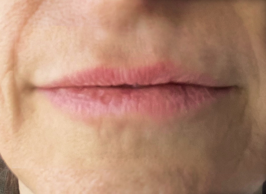 Before Image