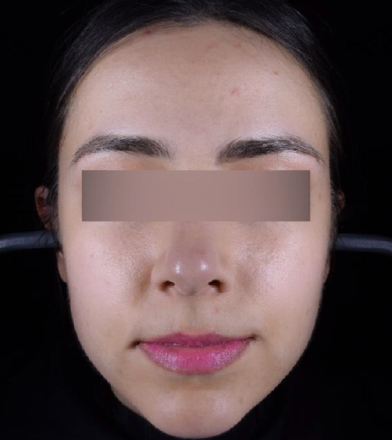 After Image