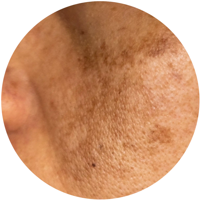 Color and texture changes