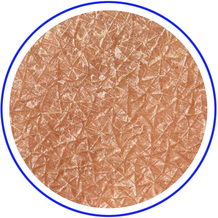 DRYNESS, REDNESS, ITCHING AND RASHES