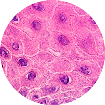 DAMAGE TO KERATINOCYTES