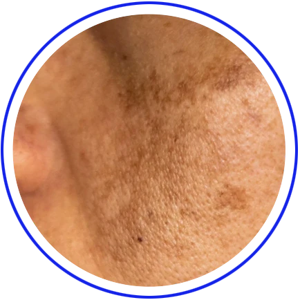 COLOR AND TEXTURE CHANGES