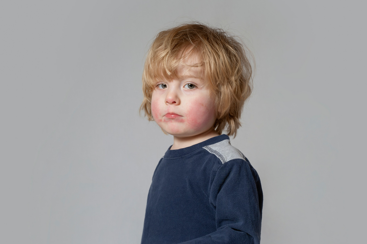 TODDLERS (1–3 YEARS)