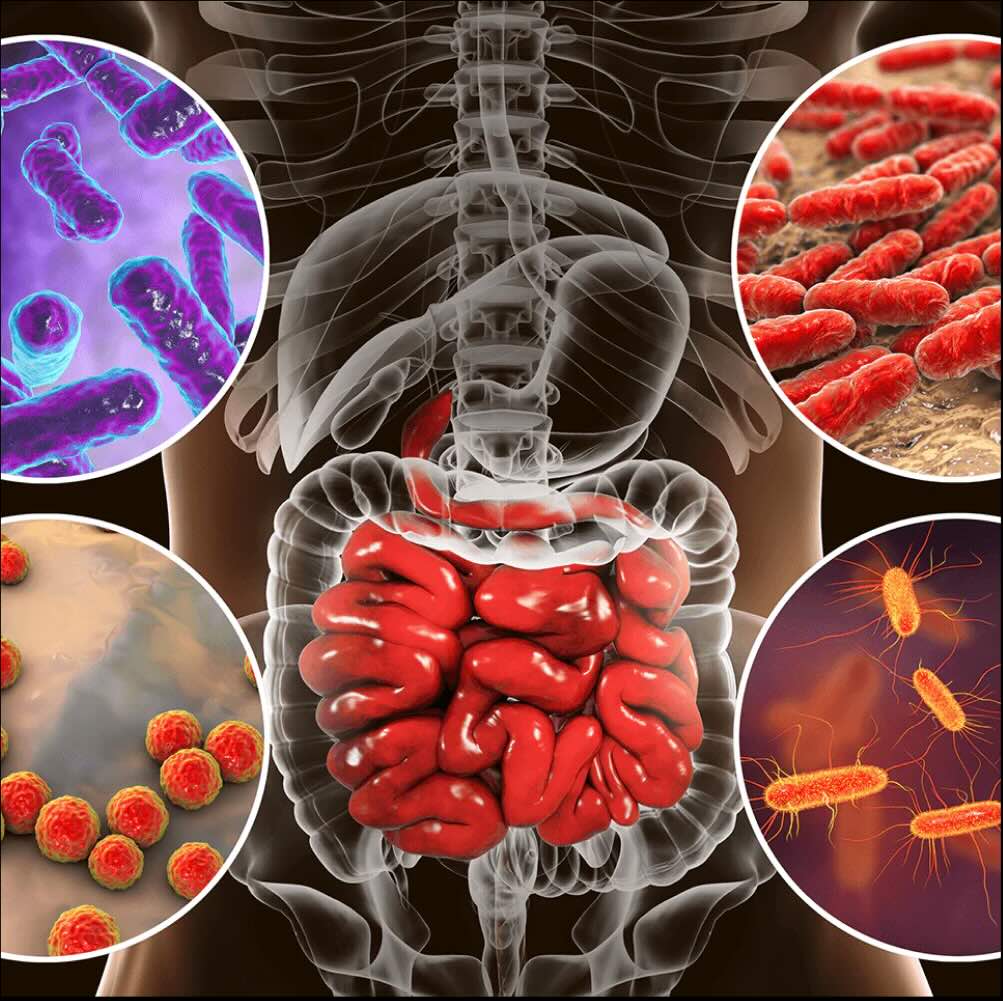 WEAK GUT BARRIER = INFLAMMATION