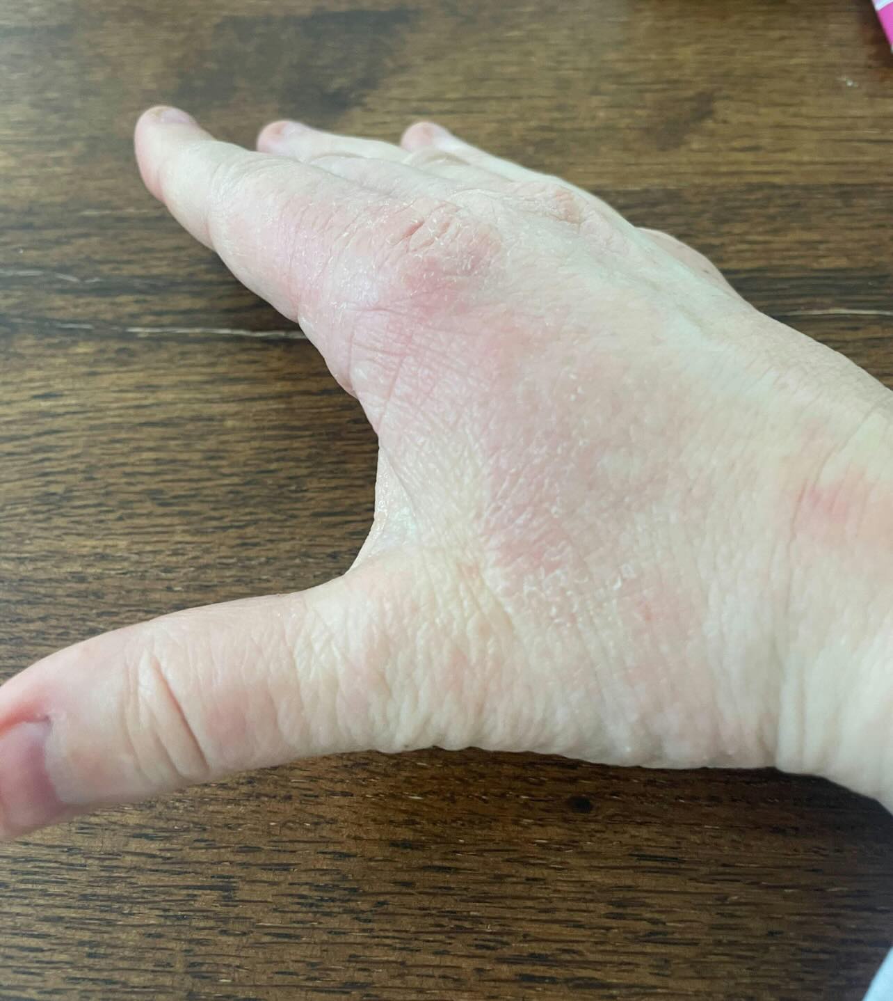 After Image