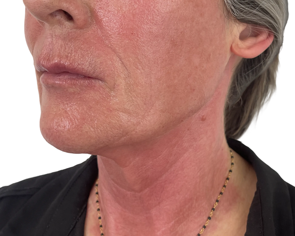 Cancer Therapy Repair