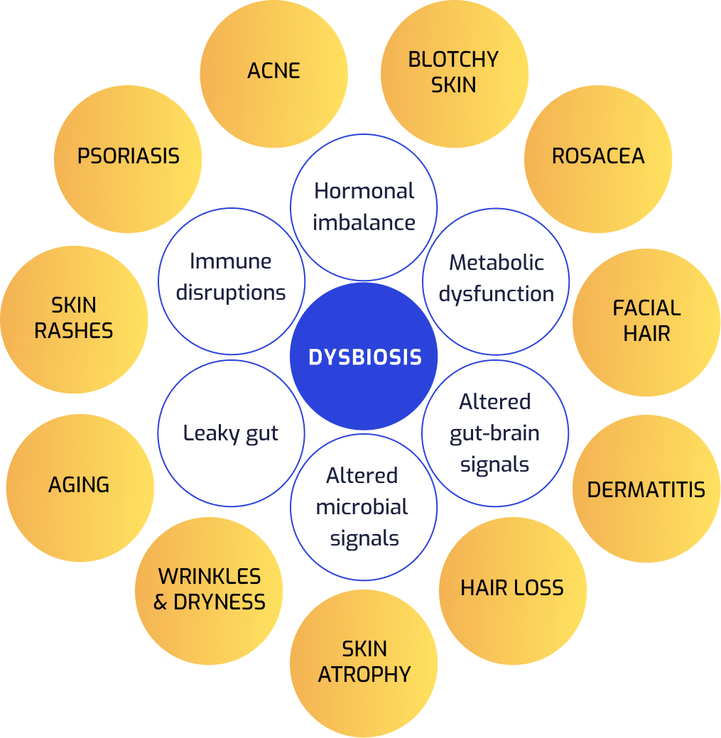 Dysbiosis graphic showing many issues with the microbiome.