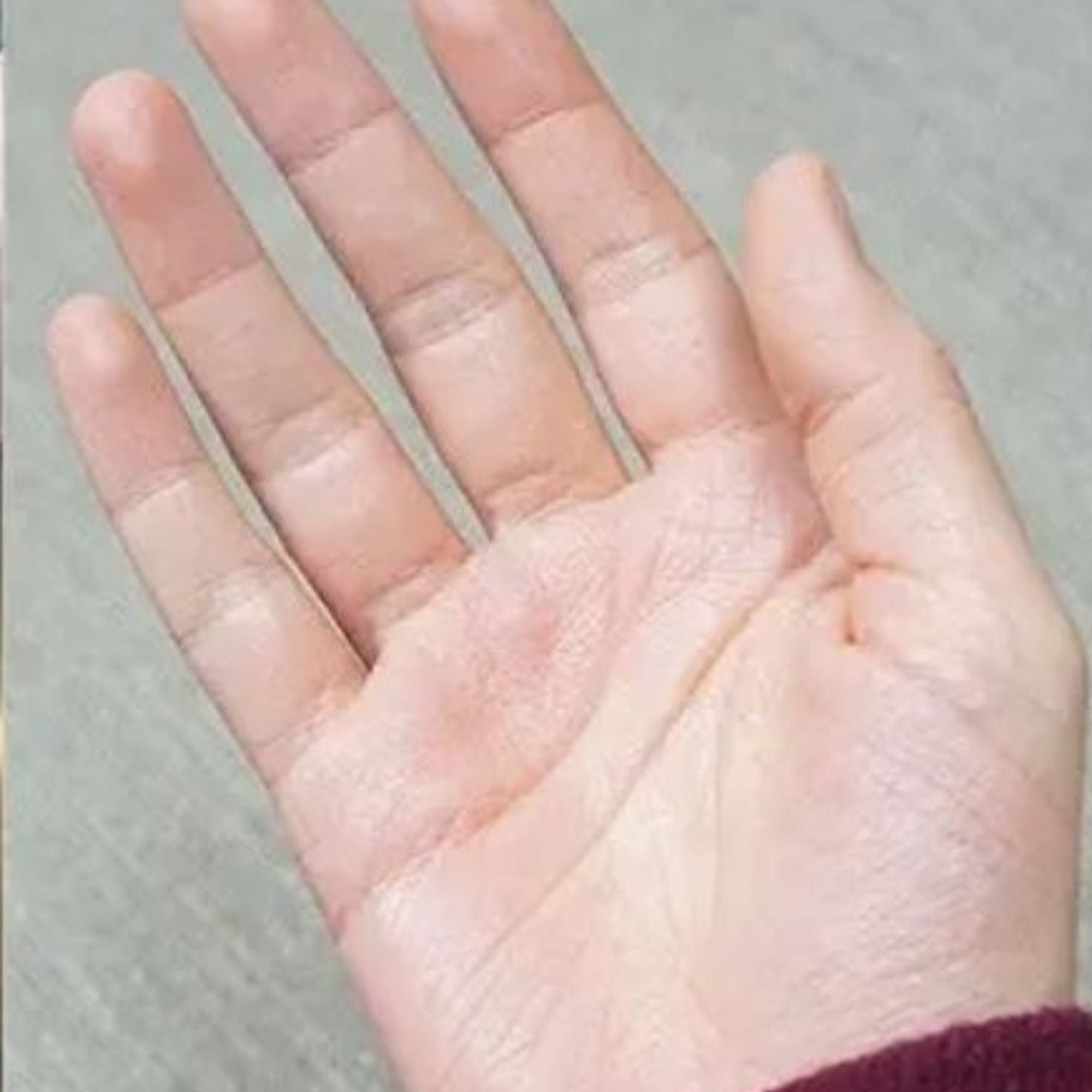 After treatment