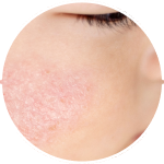 Strengthen the skin barrier