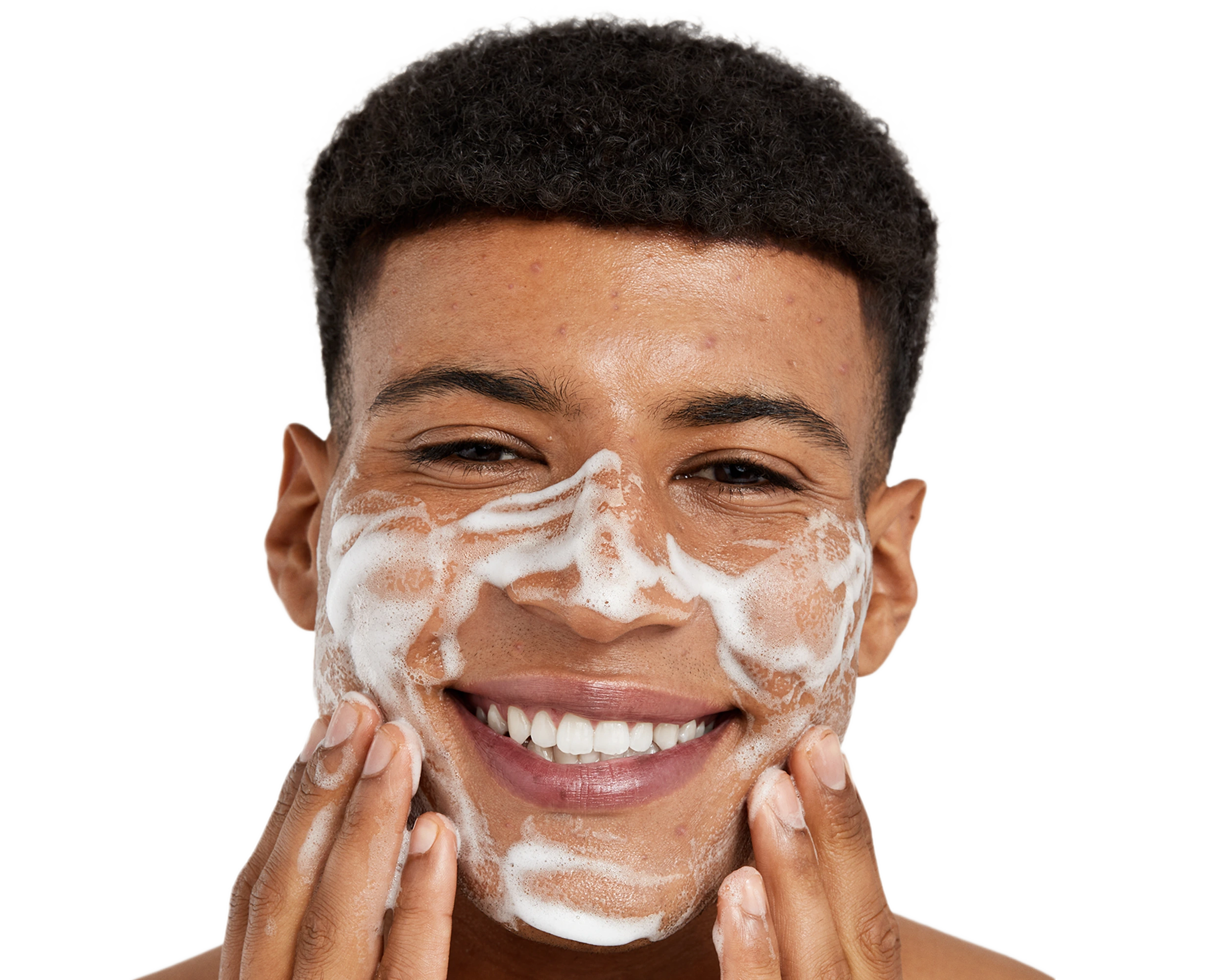 Clear Acne